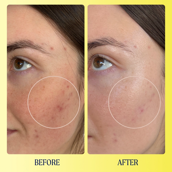 Vitamin C + Peptide Brightening Serum